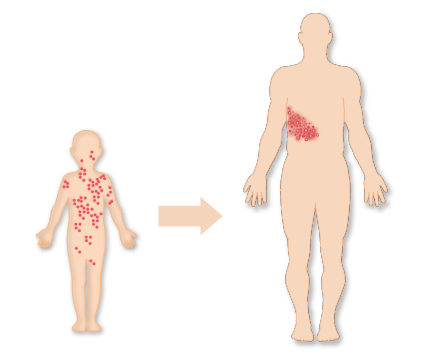 帯状 疱疹 は 癌 の 前触れ か