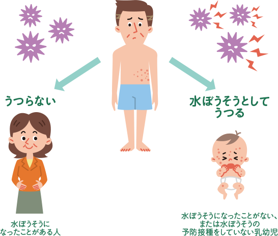 帯状疱疹は水ぼうそうになったことがある人にはうつらないが、水ぼうそうになったことのない、もしくは水ぼうそうの予防接種をしていない乳幼児には水ぼうそうとしてうつす可能性がある