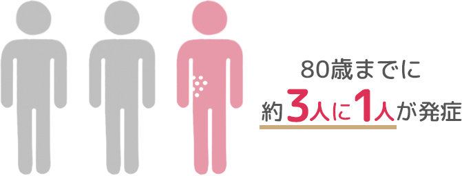 帯状疱疹は80歳までに約3人に1人が発症